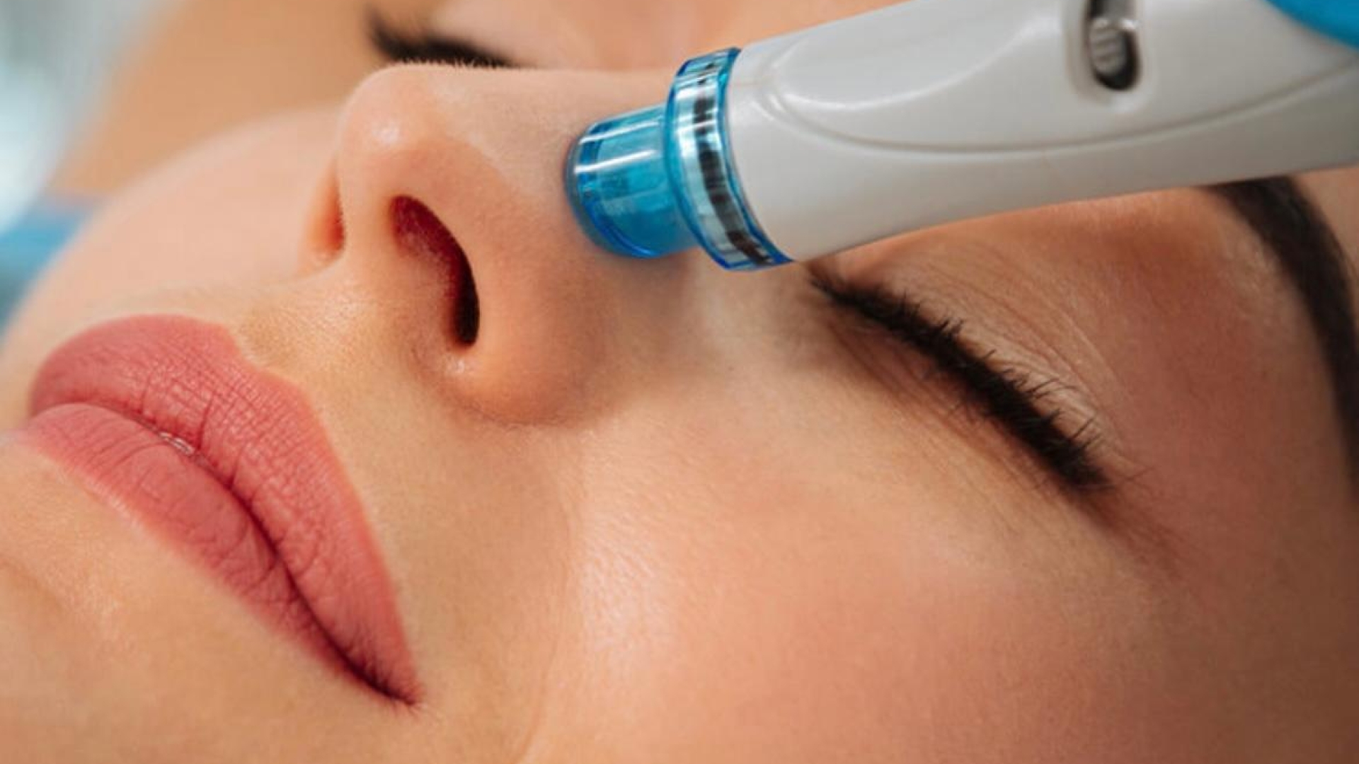 Hydrafacial